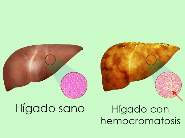 Dra. Viridiana Rodríguez Granados Especialista en Gastroenterología y Hepatología